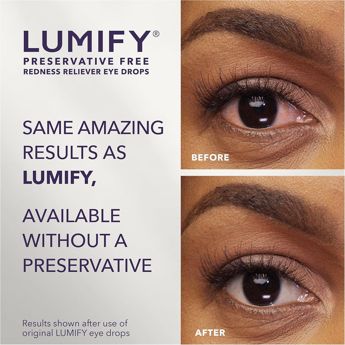 LUMIFY PF Redness Reliever Eye Drops – 20 Single-Use Vials