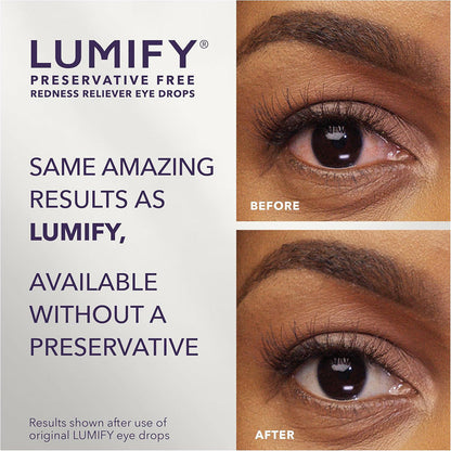 LUMIFY PF Redness Reliever Eye Drops – 20 Single-Use Vials