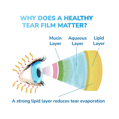 Optase Dry Eye Relief Kit – Heat Mask, Cleansing Wipes & Intense Preservative-Free Eye Drops